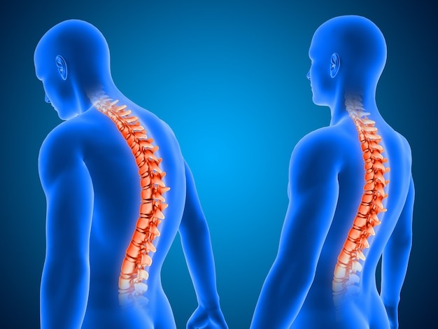 Spinal Cord Disorder